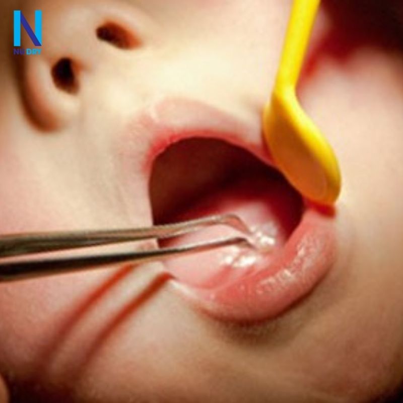 Khi Nào Cần Đưa Trẻ Đến Bệnh Viện