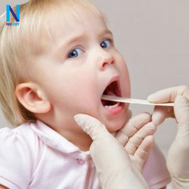 Cách Xử Lý Khi Trẻ Ăn Phải Gói Hút Ẩm