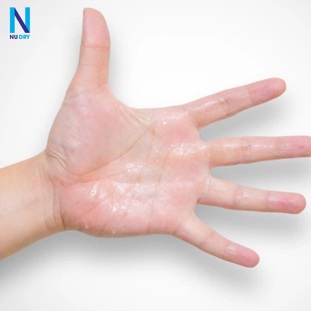 Mẹo Bảo Quản Túi Hút Mồ Hôi Tay Lâu Bền
